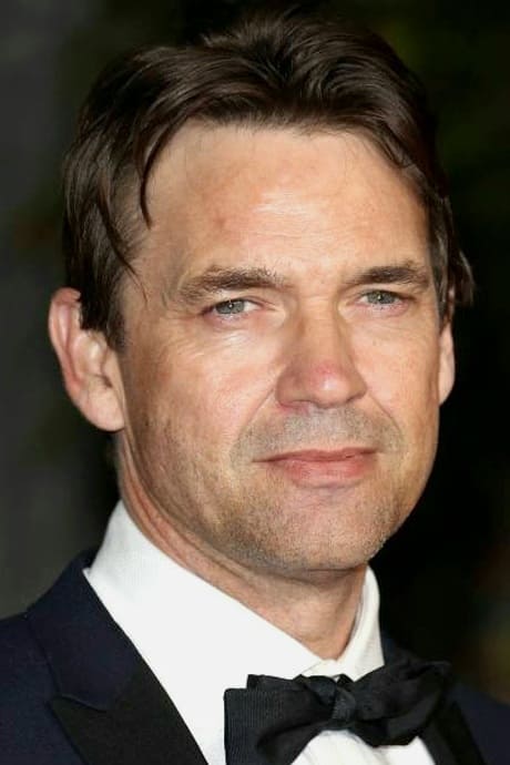 بازیگر Dougray Scott  