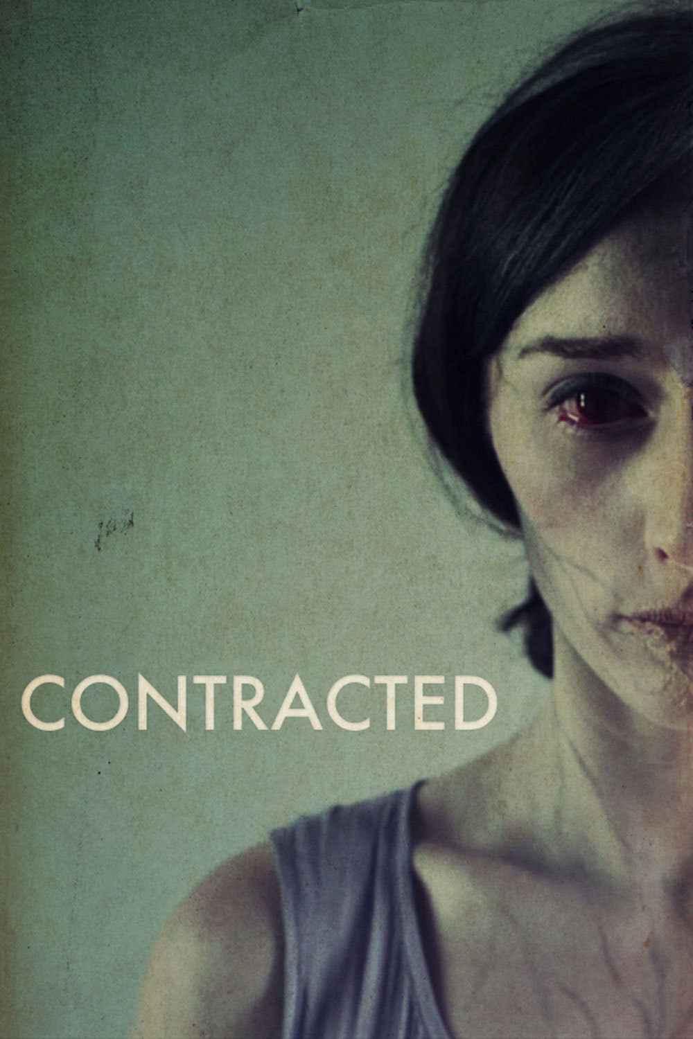 Contracted | Contracted