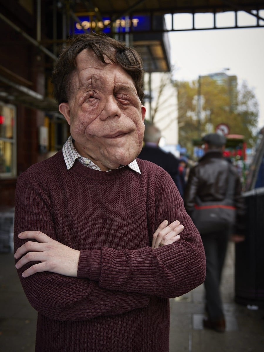 The Ugly Face of Disability Hate Crime | The Ugly Face of Disability Hate Crime