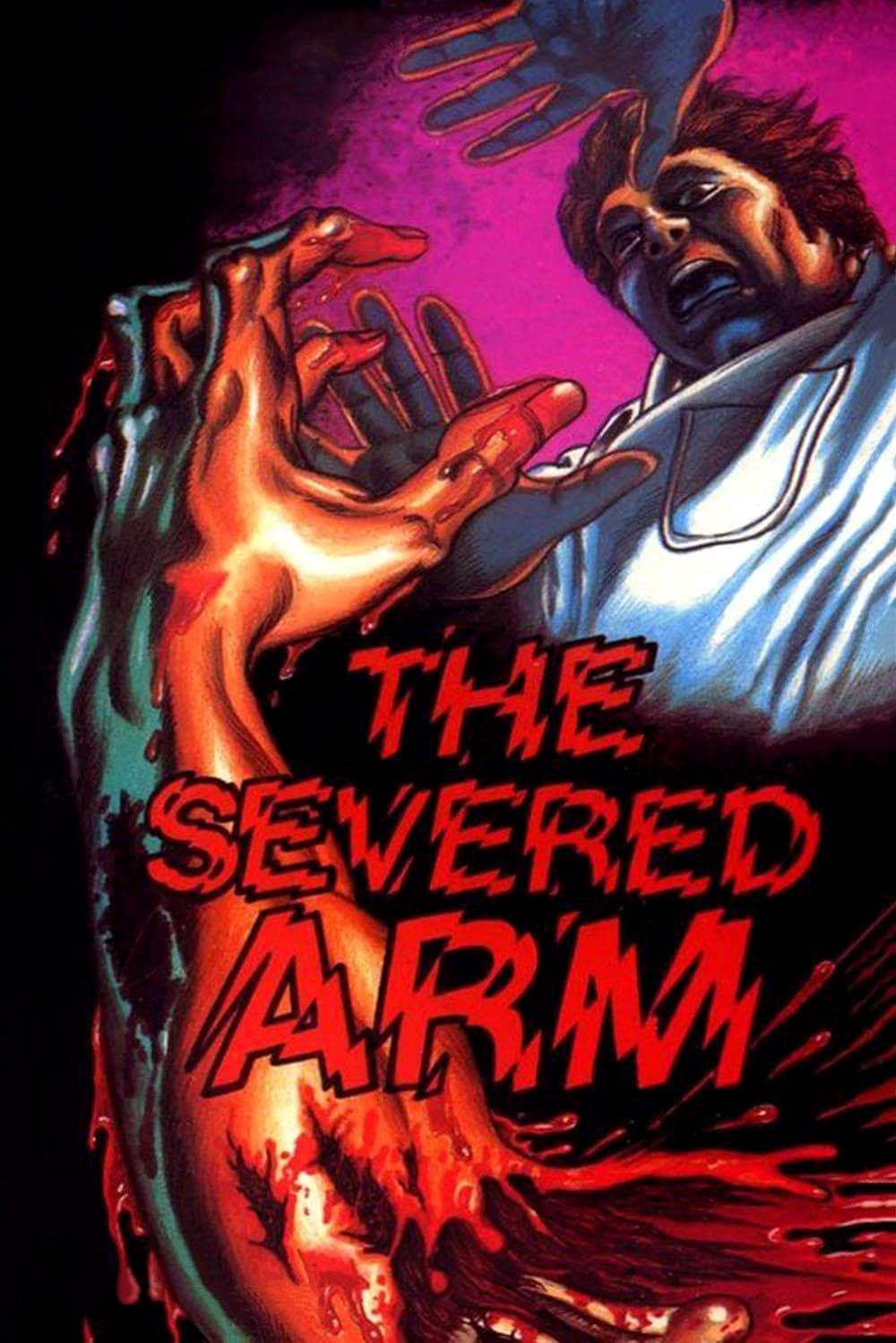 The Severed Arm | The Severed Arm