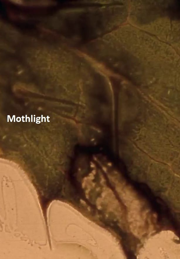 Mothlight | Mothlight