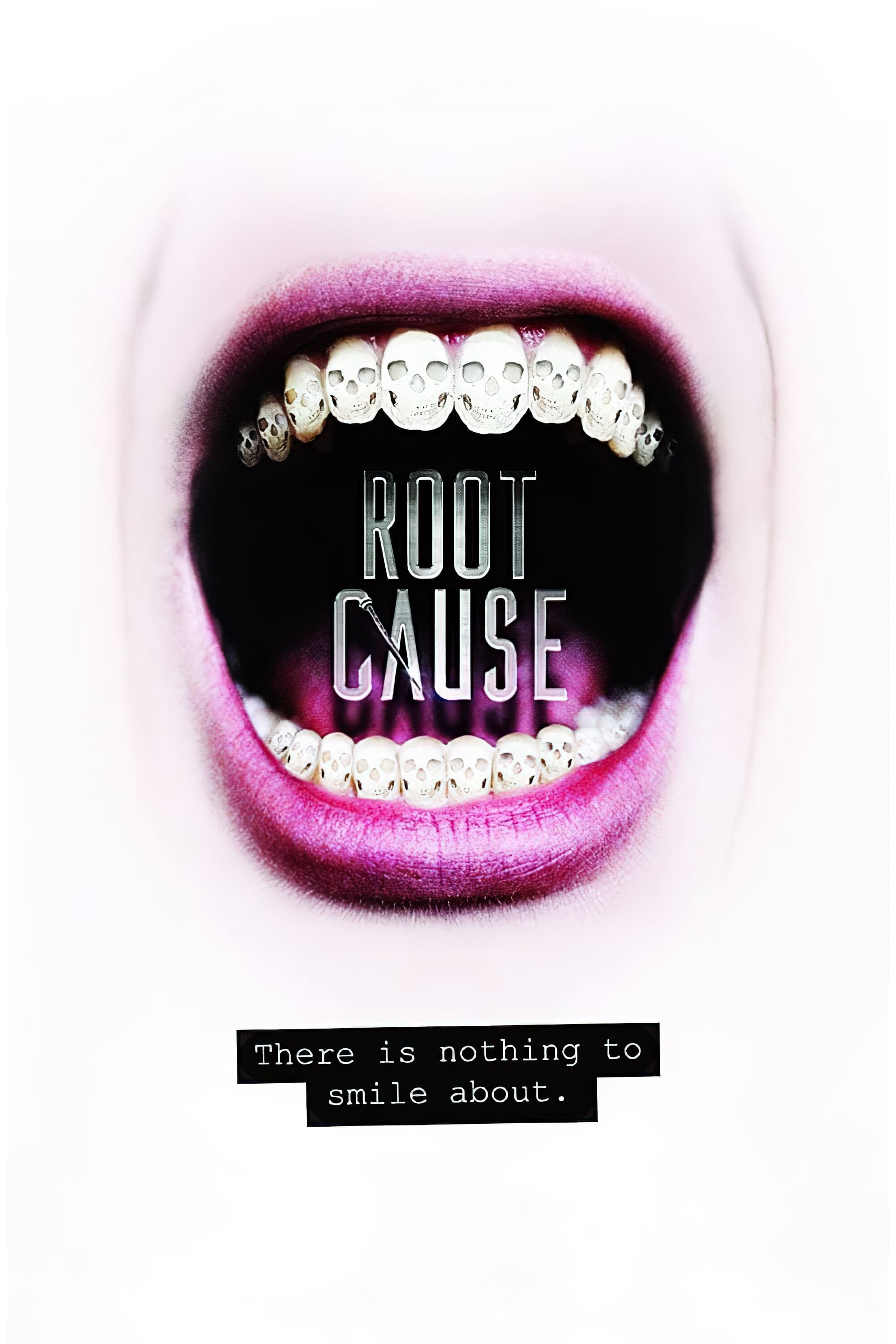 Root Cause | Root Cause