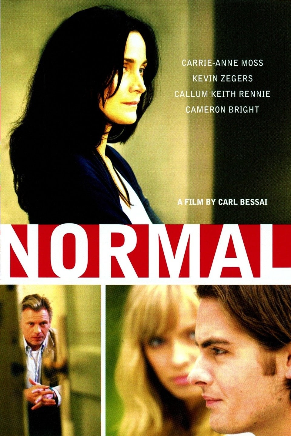 Normal | Normal