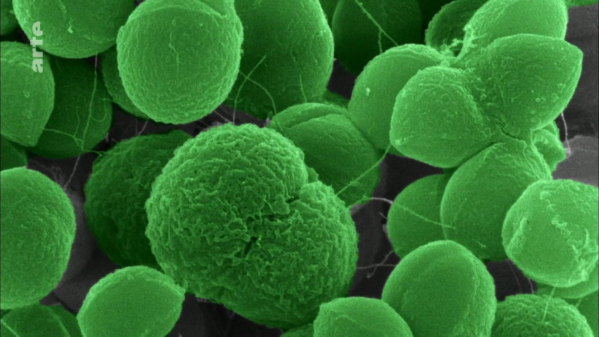 The Nature of Things: The Antibiotic Hunters|The Nature of Things: The Antibiotic Hunters