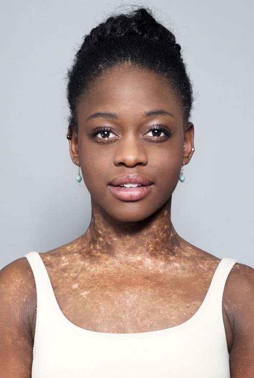 بازیگر Michaela Deprince  