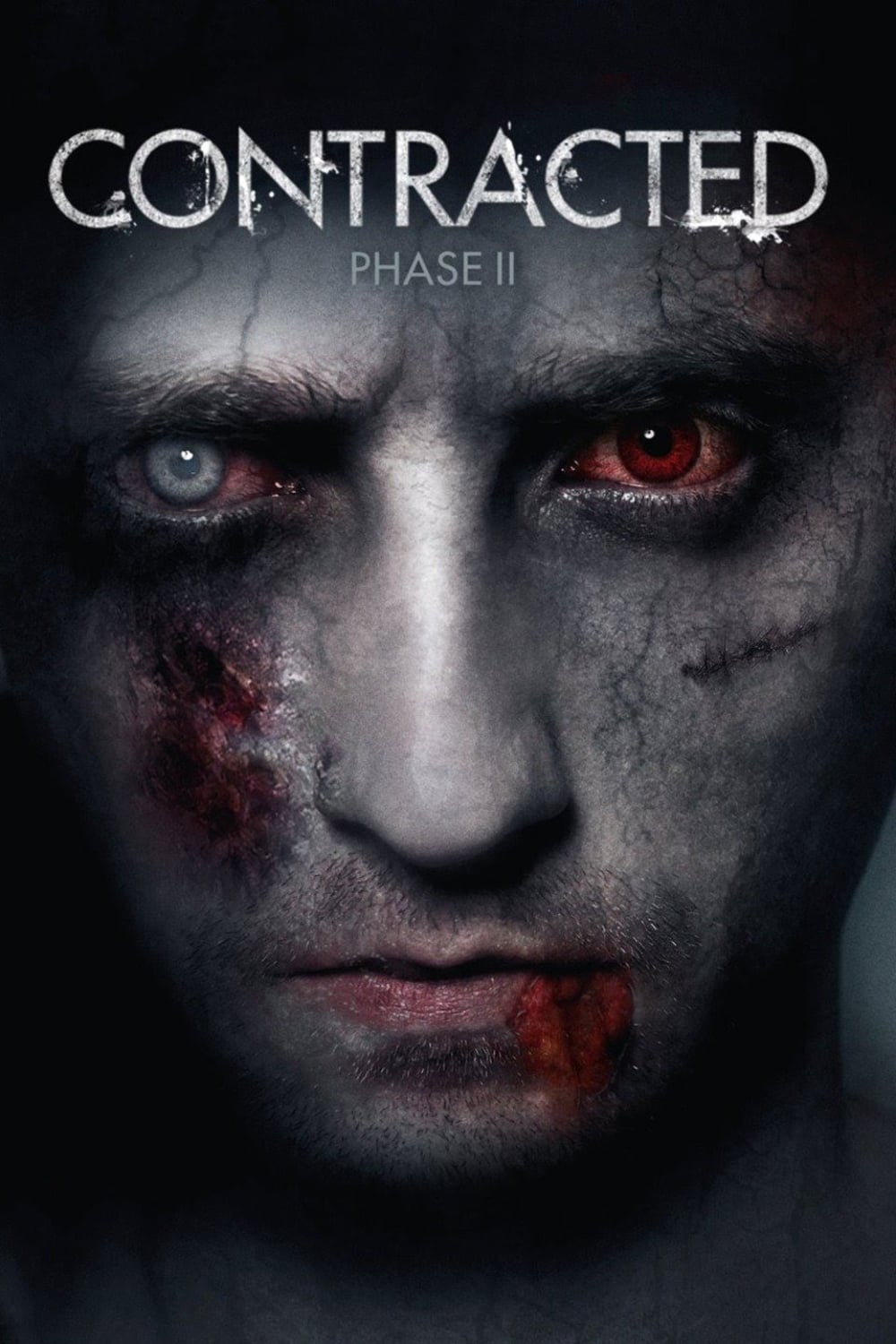 Contracted: Phase II