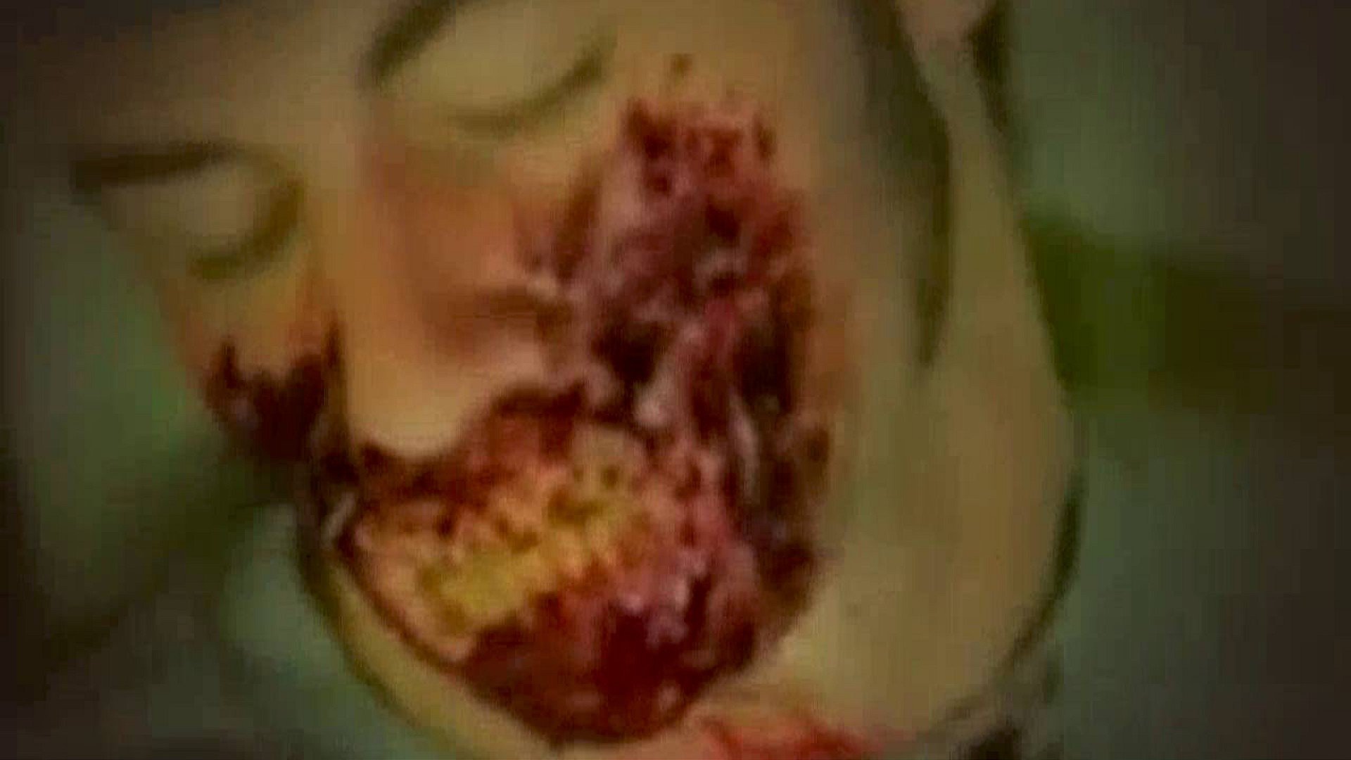 Corpses|Corpses