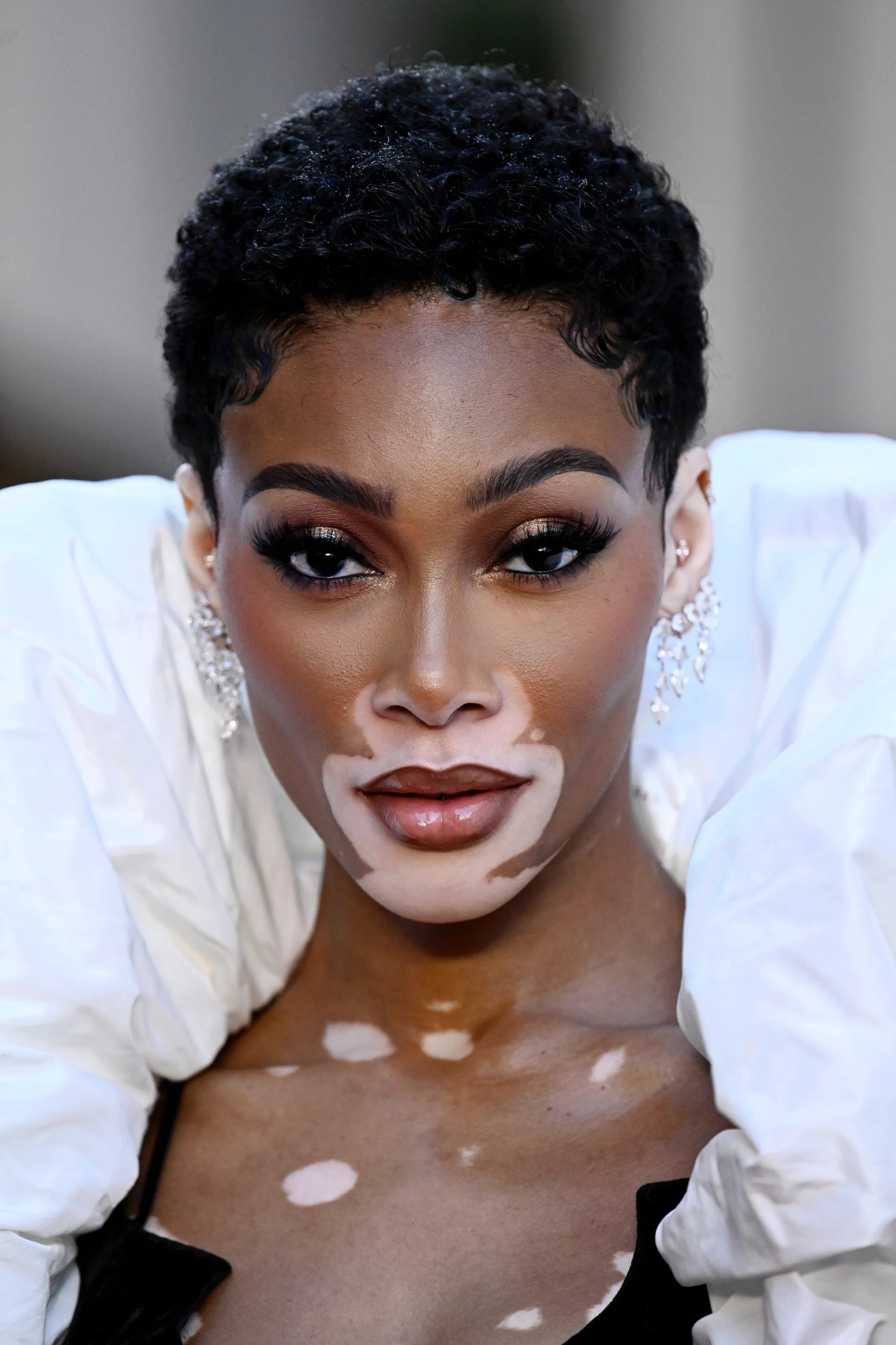 بازیگر Winnie Harlow  