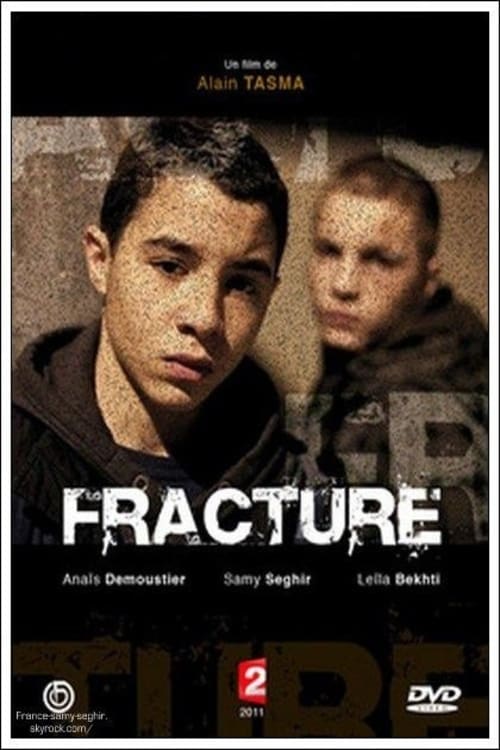 Fracture | Fracture