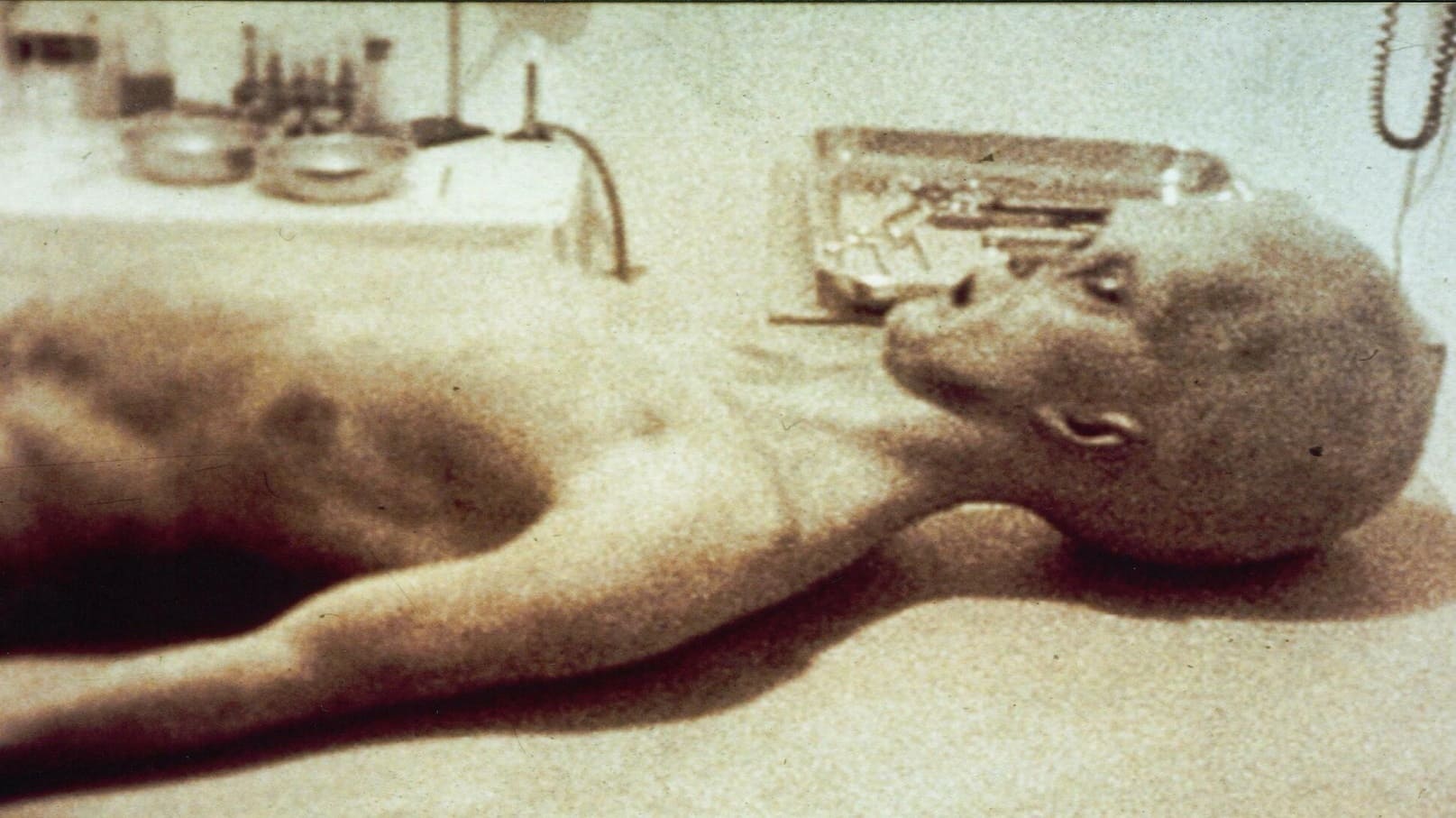 The Alien Autopsy|The Alien Autopsy