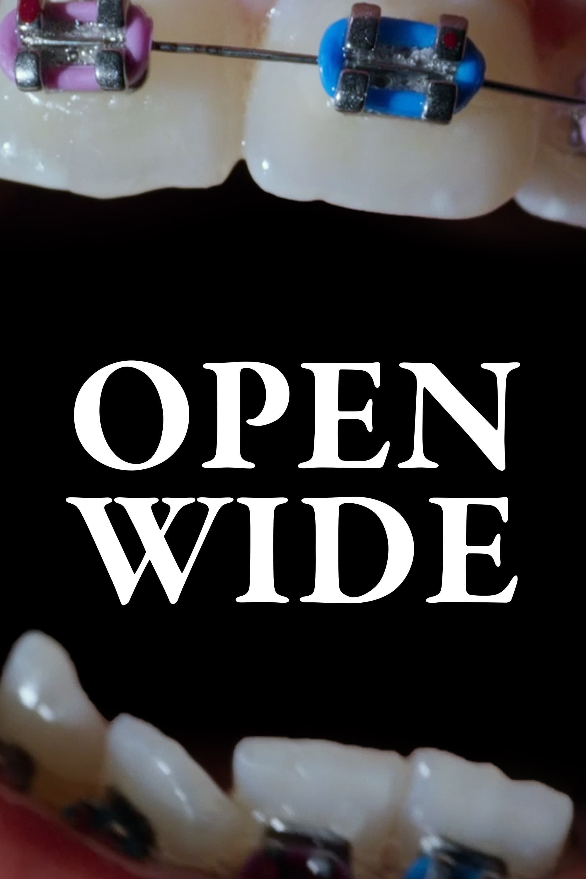 Open Wide | Open Wide