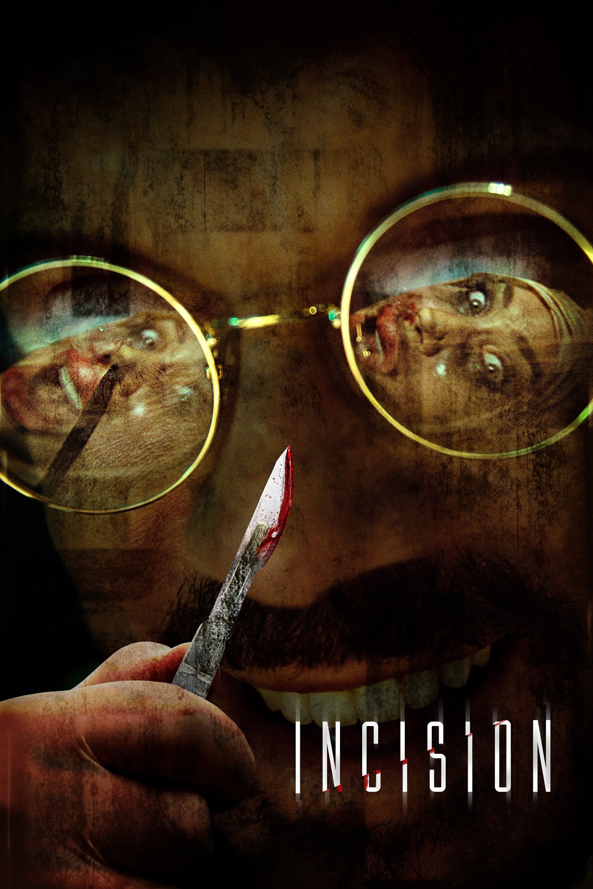 Incision | Incision