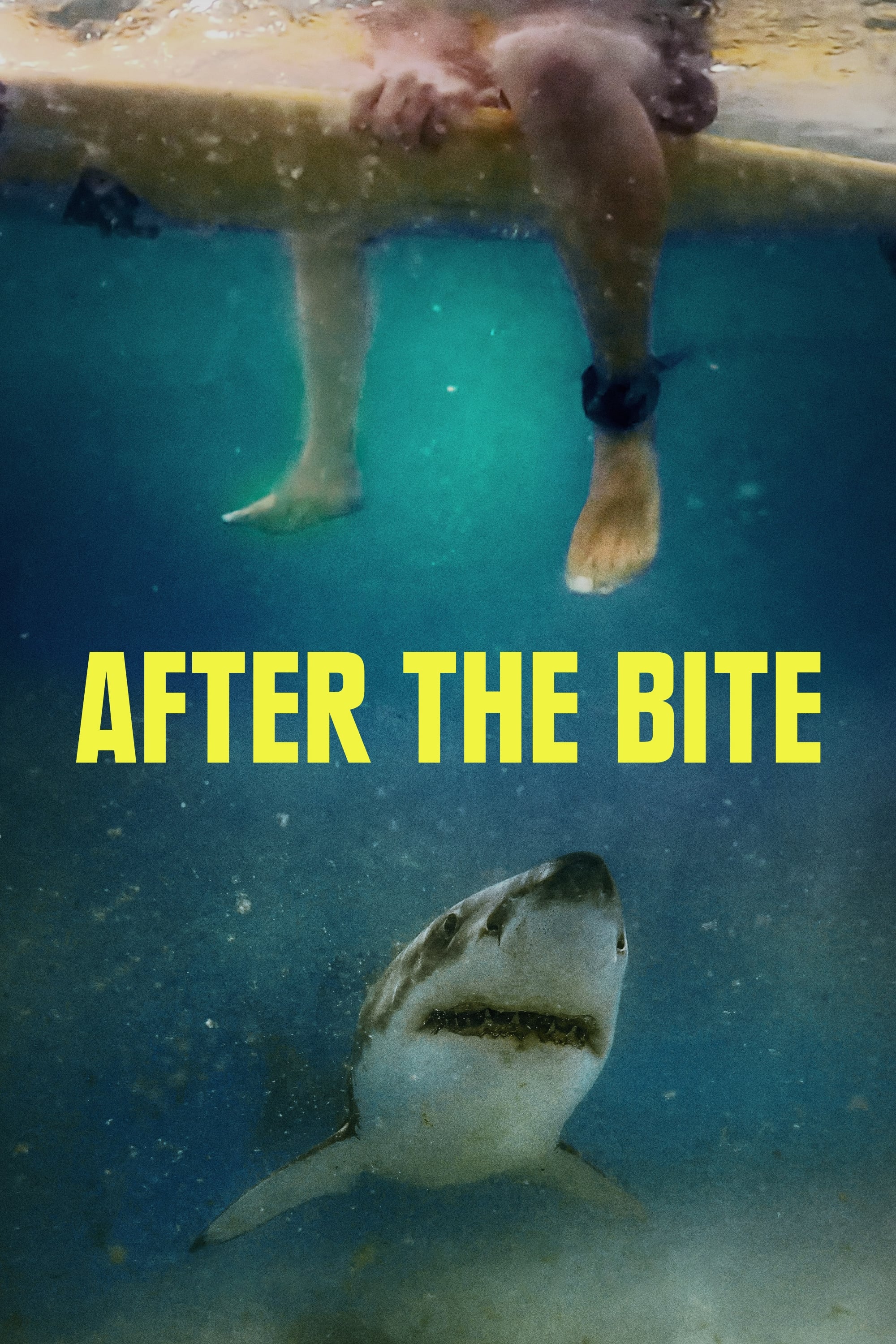 After the Bite | After the Bite